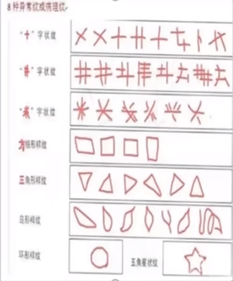 8种异常文